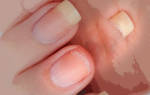 Причины ломкости ногтей на руках. Как укрепить и лечить ногти. Слабые ногти: причины и советы по уходу