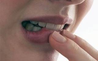 Как увлажнять губы в домашних условиях? Как ухаживать за губами зимой
