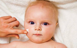 Шелушение кожи лица новорожденного: норма или патология? Что делать при шелушении кожи у новорожденного