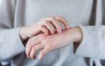Как увлажнить кожу рук в домашних условиях. Причины и факторы появления на кистях и пальцах рук. Почему сохнет кожа на руках