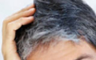 Седые волосы: в чём же причина? От чего седеют волосы и как с этим бороться