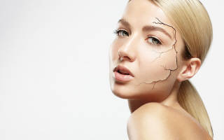 Причины сухости кожи тела и лица. Как избавиться от сухости кожи? Другие возможные причины