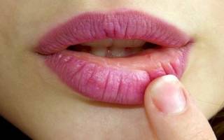 Почему очень сильно сохнут губы. Почему губы могут сохнуть, гореть, трескаться и шелушиться