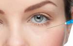 Гиалуроновая кислота для кожи вокруг глаз. Как убирают мешки под глазами с помощью гиалуроновой кислоты