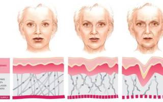 Ваши секреты красоты. Как замедлить старение лица и предотвратить появление морщин. Морщины и их виды. Причины раннего появления морщин. Как образуются морщины, и как от них избавиться