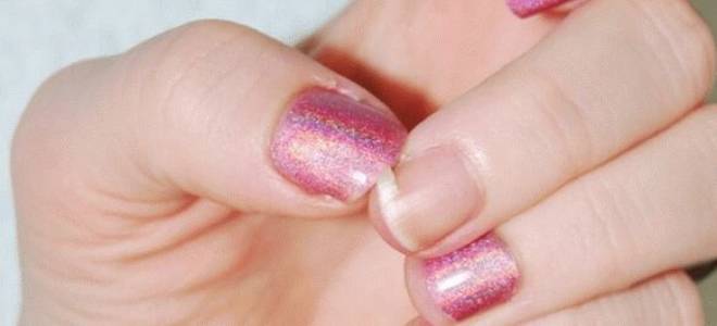 К чему снится, что ломаются ногти? Что сулит сломанный ноготь во сне