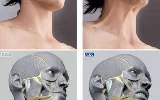 Как убрать дряблую шею. Как подтянуть шею с помощью операции? Дряблая кожа на шее: восстановительные процедуры