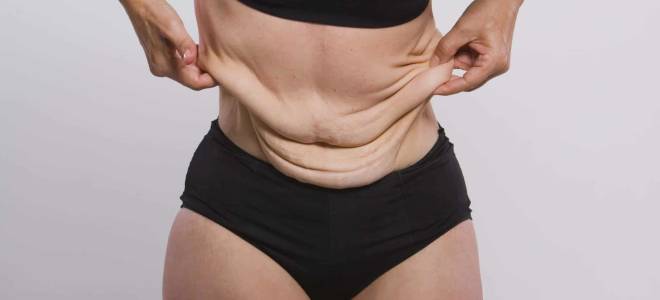 Как избавиться от дряблой кожи тела. Народные средства для упругости кожи лица. Народная медицина в борьбе за молодость кожи