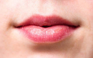 Как решить проблему обветренных губ. Как вылечить обветренные губы в домашних условиях