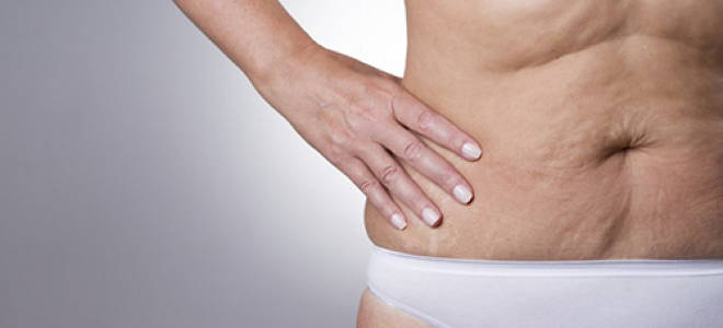 Обменные процессы повышается эластичность кожи. Принимайте контрастный душ. Почему кожа теряет упругость и как с этим бороться