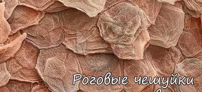 Эпидермис кожи человека формируется из. Как быстро обновляется кожа