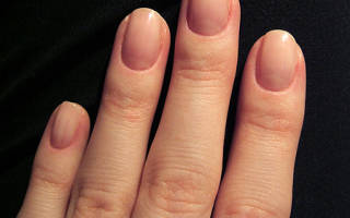 Что делать, если слоятся ногти на руках: способы лечения в домашних условиях. Слоятся, крошатся, ломаются ногти: почему очень тонкие ногти, лечение, что делать в домашних условиях