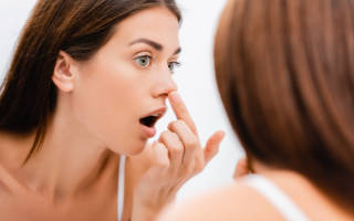 Как избавиться от черных точек на носу в домашних условиях. Черные точки (комедоны) на коже лица и тела. Как избавиться от черных точек в домашних условиях? Маски, скрабы. Какие бывают комедоны